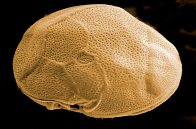 Ejemplar de Gambierdiscus excentricus visto al microscopio electrónico