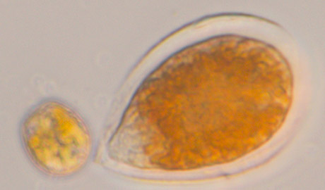 Células de Ostreopsis y Prorocentrum conviviendo en uno de los experimentos