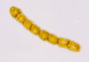 Gymnodinium catenatum.jpg -