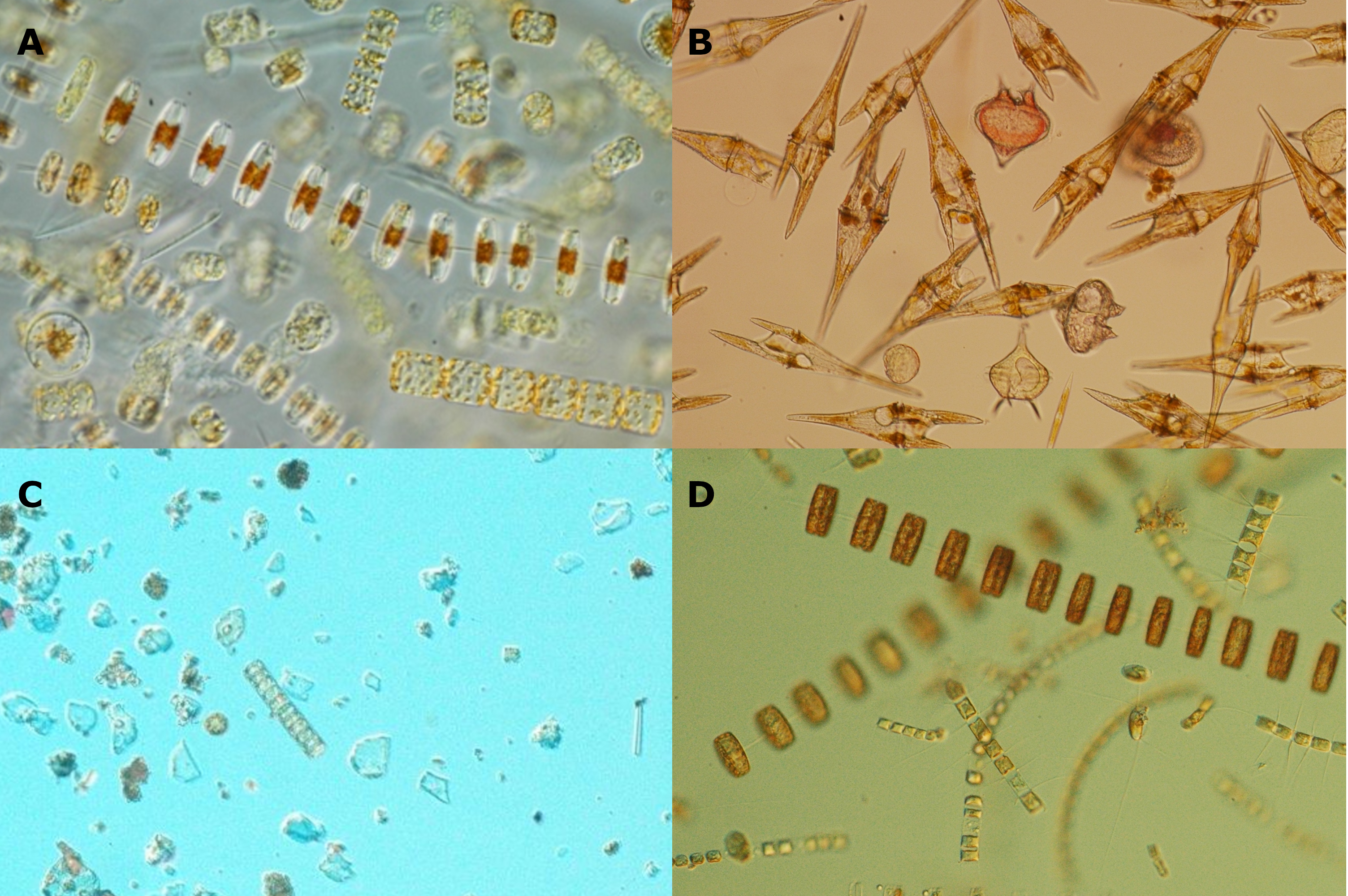 Secuencia de fotos de muestras de fitoplancton vivo vistos al microscopio que muestran la composición bajo distintas condiciones: afloramiento (11 octubre 2017) dominan las diatomeas; relajación tras el afloramiento anterior (18 octubre 2017), dominan los dinoflagelados; situación de invierno ( 8 enero 2018), muy poco fitoplancton, diatomeas pequeñas; afloramiento tras el invierno (2 mayo 2018), abundancia de diatomeas. © VGOHAB