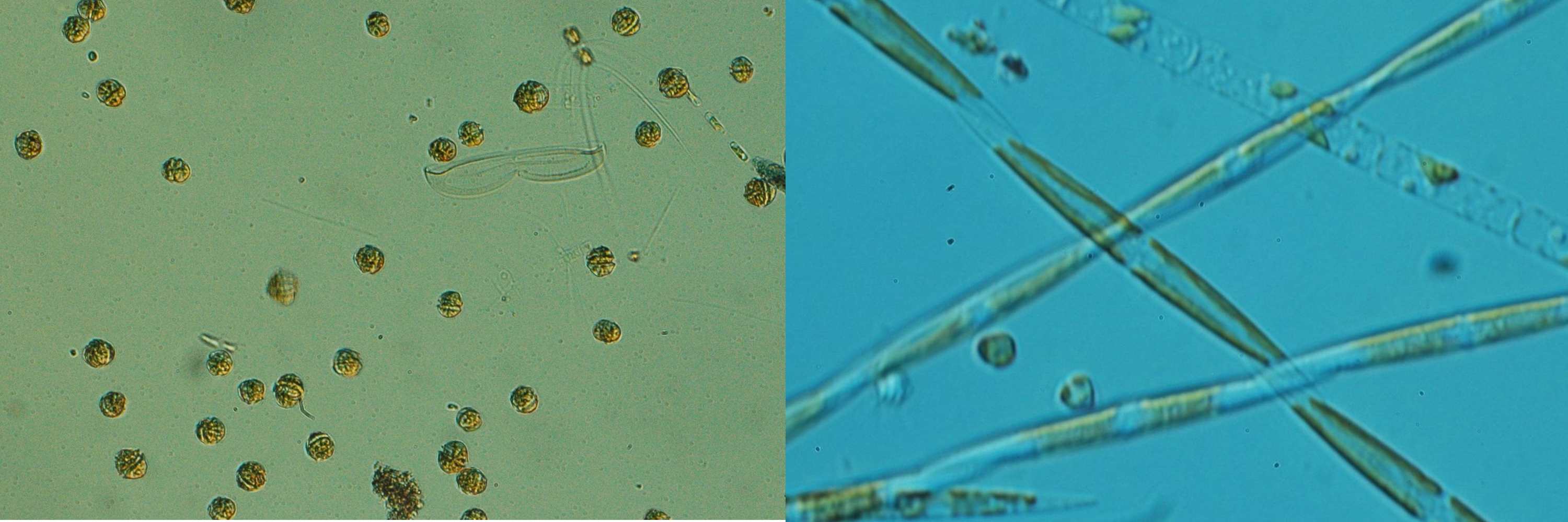 Muestras de fitoplancton vivo. En la imagen de la izquierda domina Alexandrium minutum, dinoflagelado productor de toxina paralizante (PSP, paralytic shellfish poisoning), y en la de la derecha Pseudo-nitzschia cf. australis (>5 µm), diatomea productora de toxina amnésica (ASP, amnesic shellfish poisoning). Imágenes tomadas mediante microscopía óptica (DIC = contraste de interferencia diferencial), capturadas a 100× y 400×.