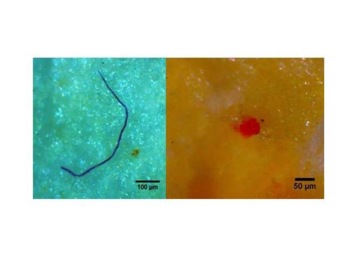 Imágenes de microplásticos encontrados en la Ría de Vigo